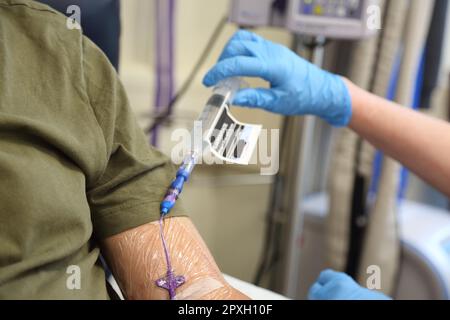 Chemotherapie-Medikament Fluorouracil wird in Picc Line des männlichen Krebspatienten im Krankenhaus Surrey England injiziert Stockfoto