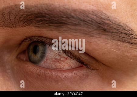 Porträt des schmerzhaften weiblichen Gesichts mit allergischen Augen nach brauner Augenbrauenkorrektur zu Hause ohne Wissen Stockfoto