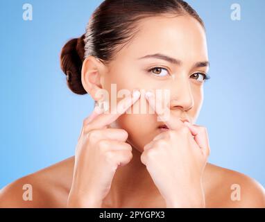 Frau, Gesicht und Pickel, Akne und Gesichtsnarbe auf blauem Studiohintergrund. Porträt eines jungen weiblichen Models, das sich um Hautpflegeprobleme, ästhetische Schönheitskosmetika und Knallkopf mit Fingern sorgt Stockfoto