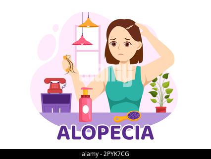 Alopezie Illustration mit Haarausfall Autoimmunerkrankung und Glatze im Gesundheitswesen flache Cartoon handgezogene Banner oder Landing-Page-Vorlagen Stockfoto