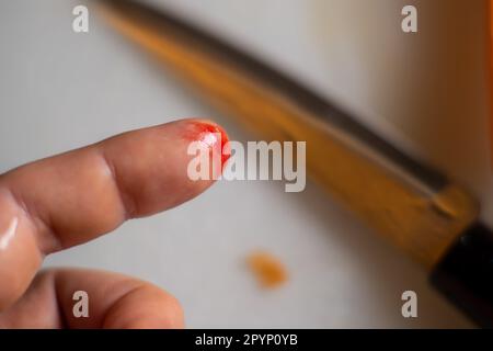 Fingerschnitt in der Küche. Männlicher Finger mit Wunde und Blut auf einem verschwommenen Hintergrund eines Küchenmessers. Stockfoto