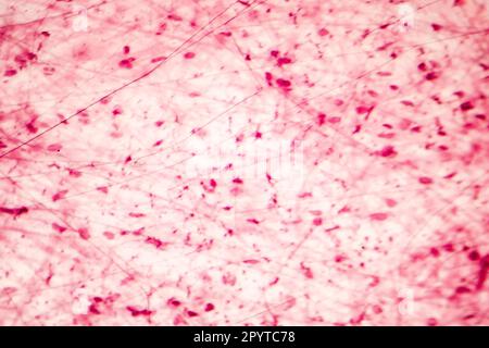 Loses Bindegewebe des Menschen, Lichtmikrograph, Hämatoxylin- und Eosin-Färbung Stockfoto