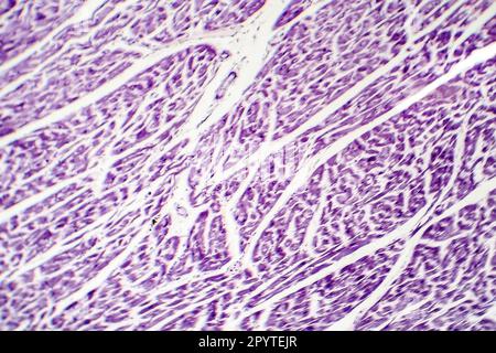 Menschlicher Herzmuskel, Lichtmikroskop. Gestreifte Herzmuskelzellen oder Myozyten Stockfoto