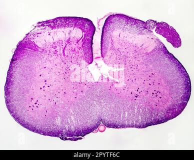 Menschliches Rückenmark, Querschnitt. Lichtmikrographie, die die weiße und die graue Substanz mit dorsalen und ventralen Hörnern zeigt Stockfoto