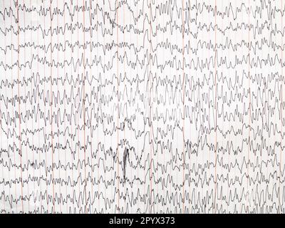 Enzephalogramm auf dem Papier - Diagramm der elektrischen Aktivität des Gehirns Stockfoto