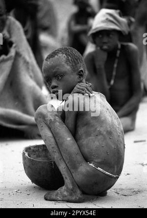 SDN , SUDAN : Ein von Fliegen heimgesuchter Unterernährter Junge in einem Fütterungszentrum in Waat im Süden des Sudan 20.10.1992 Stockfoto