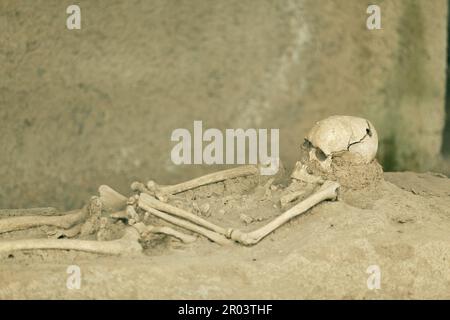 Römisches Skelett mit trepaniertem chirurgischen Eingriff-Schädelgrat Stockfoto