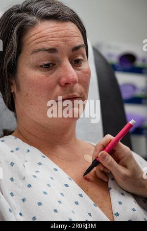 Dermatologe wird gerade eine Linie auf junge 30s-Frau für die Exzision von Basalzellkarzinomen in der Klinik ziehen. Stockfoto