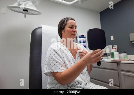 Das horizontale Bild eines jungen 30s-Dermatologen untersucht die mögliche Exzisionsstelle eines Basalzellkarzinoms auf der weiblichen Brust. Stockfoto