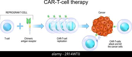 CAR-T-Zell-Therapie. Krebsimmuntherapie. Abtötung von Tumorzellen. Gentechnisch hergestellt. Personalisierte Medizin. Vektordarstellung Stock Vektor