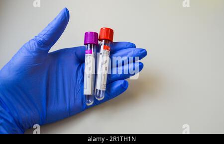 Eine Hand mit blauen Handschuhen hält ein Reagenzglas mit blauem Stopfen. Arbeitsplatz wird kopiert. Es ist Platz für den Text vorhanden. Medizinische Geräte. Stockfoto