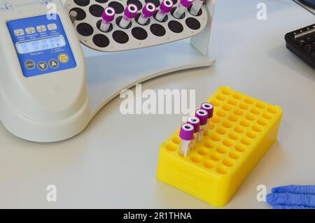 Zentrifugieren und Pipettieren von Reagenzgläsern mit Blut. Durchführung von Laboruntersuchungen unter Schussbedingungen. Für Ihre Gesundheit sorgen. Röhrchen mit Stockfoto