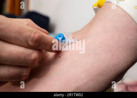 Einführen eines intravenösen Tropfens in einen männlichen Arm, Soft Focus Nahaufnahme Stockfoto