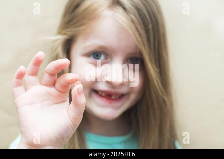 Porträt eines kleinen, süßen blonden Kindes, das ihren Milchzahn in den Händen hält und auf beigefarbenem Hintergrund lächelt. Milchzahnverlust Stockfoto