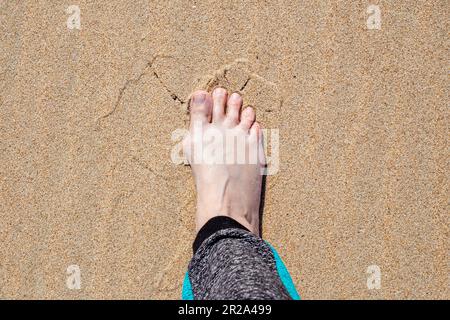 Weibliches Bein mit vergrößertem, schmerzhaftem Gelenk am Grosszehe auf gelbem Sand. Stockfoto