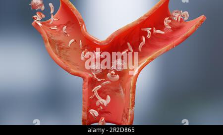 Blutkörperchen- oder Hämoglobinanämie und normal. Aplastische Anämie, normale und abnorme Anzahl von Blutzellen und Blutplättchen, Blutkreislauf in einer Arterie oder Stockfoto