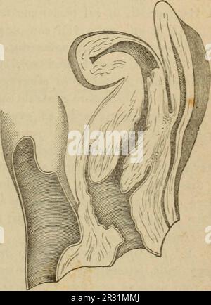 'Patologia e terapia delle malattie delle donne ad uso dei medici pratici' (1894) Stockfoto