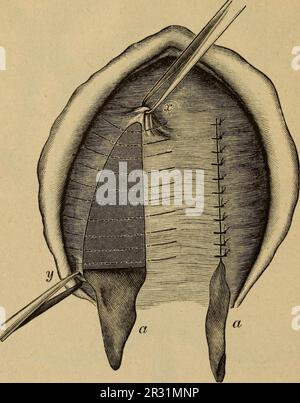 'Patologia e terapia delle malattie delle donne ad uso dei medici pratici' (1894) Stockfoto