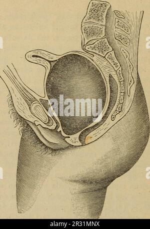 'Patologia e terapia delle malattie delle donne ad uso dei medici pratici' (1894) Stockfoto