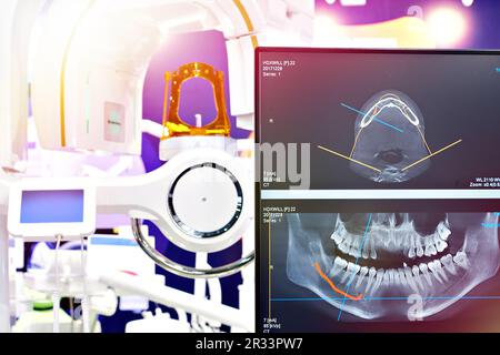 Moderner zahnärztlicher digitaler 3D-Tomographen Stockfoto