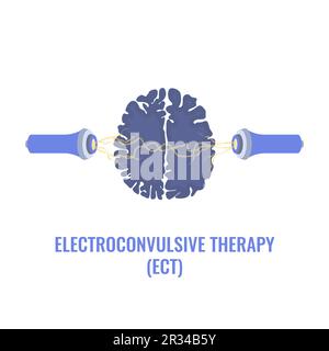 Elektrokrampftherapie bei schwerer Depression Stock Vektor