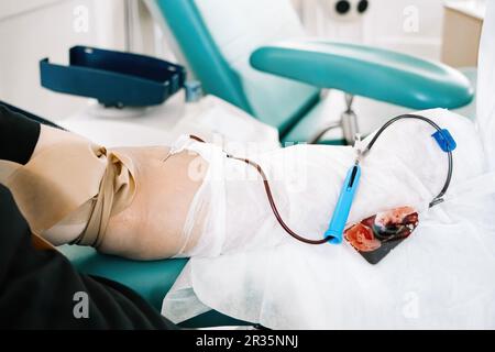 Internationaler Tag Der Blutspende. Der Mensch spendet Blut im medizinischen Labor. Der Blutspender spendet Blut für die lebensrettende und medizinische Forschung. Stockfoto