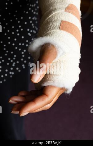 Frauenlinkshand im Gipsverband wegen gebrochenem Handgelenk. Stockfoto