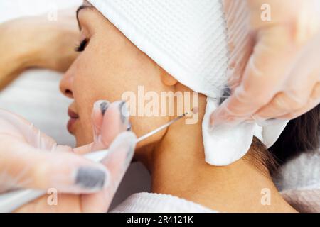 Eine schöne weiße junge Frau führt eine Leberfleckenentfernung an ihrem Hals durch, in einer modernen Kosmetik-hautklinik Stockfoto