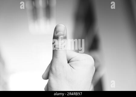 Mann mit Hand und Finger in Pain​ mit roter Markierung Stockfoto