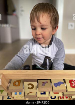 Kleines Kleinkind mit Windpocken-Ausschlag, der auf dem Boden spielt Stockfoto