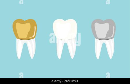 Satz goldweißer und silberner Molarzähne Stock Vektor
