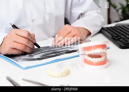 Der Zahnarzt zeigt Problembereiche bei Zähnen am künstlichen Kiefer Stockfoto