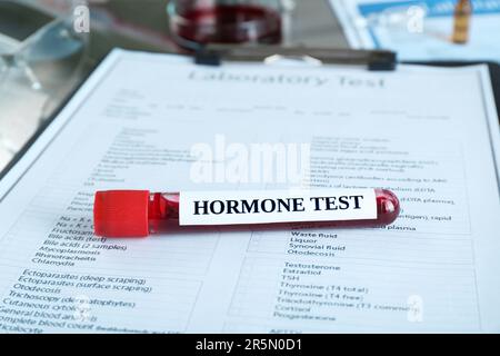 Glasröhrchen mit Blutprobe und Etikett Hormone Test auf dem Klemmbrett Stockfoto