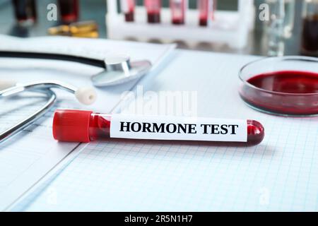 Glasröhrchen mit Blutprobe und Markierung Hormone Test am Tisch Stockfoto