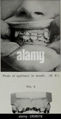 „Der Dental-Kosmos“ (1914) Stockfoto