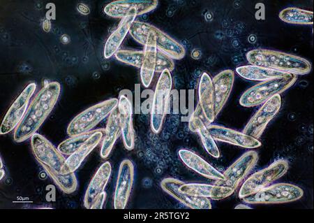 Ciliate, wahrscheinlich Paramecium sp. Stockfoto