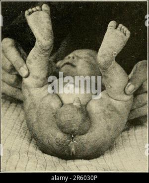 „Krankheiten von Kindern“ (1916) Stockfoto