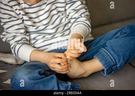 Kind mit Hautausschlag, Roseola, Hand-Fuss-und-Klauenseuche, Kind-Hautausschlag-Krankheit Stockfoto