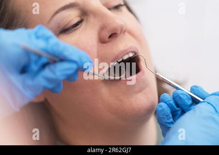 Weibliches Gesicht in der zahnärztlichen Praxis mit Präzision und Sorgfalt behandelt Stockfoto