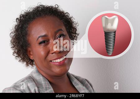 Glückliche afroamerikanische Frau mit perfekten Zähnen, die auf weißem Hintergrund lächeln. Darstellung des Zahnimplantats Stockfoto