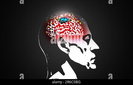 Microchip ist in das menschliche Gehirn implantiert. Nervenimplantate. Gehirn-Computer-Schnittstelle. Neuron-Technologie-Konzept - Illustration Stockfoto