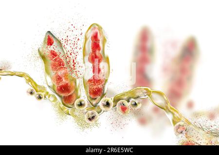 Zerstörung des Athleten-Fusspilzes Trichophyton mentagrophytes, Computerdarstellung. Konzeptionelles Bild zur Fussbehandlung und -Prophylaxe beim Athleten. Stockfoto