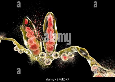 Zerstörung des Athleten-Fusspilzes Trichophyton mentagrophytes, Computerdarstellung. Konzeptionelles Bild zur Fussbehandlung und -Prophylaxe beim Athleten. Stockfoto