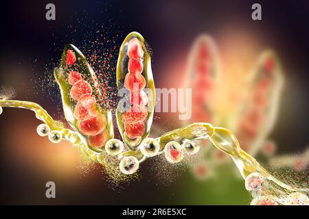 Zerstörung des Athleten-Fusspilzes Trichophyton mentagrophytes, Computerdarstellung. Konzeptionelles Bild zur Fussbehandlung und -Prophylaxe beim Athleten. Stockfoto