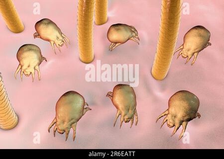 Staubmilben (Dermatophagoides pteronyssinus) auf menschlicher Haut, Computerdarstellung. Diese Milbe hat acht Beine. Sein abgerundeter, unsegmentierter Körper weist einige t auf Stockfoto