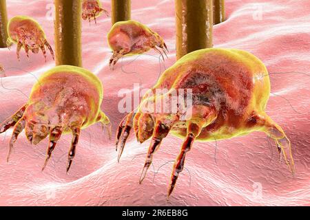 Staubmilben (Dermatophagoides pteronyssinus) auf menschlicher Haut, Computerdarstellung. Diese Milbe hat acht Beine. Sein abgerundeter, unsegmentierter Körper weist einige t auf Stockfoto