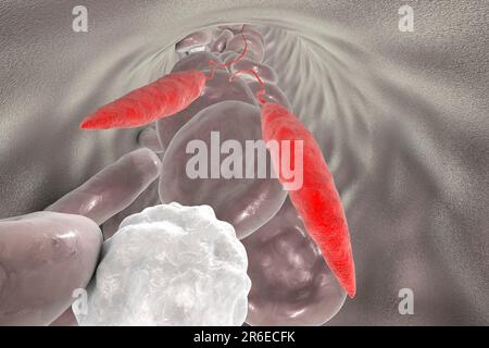 Leishmania sp. Protozoen im Blut, Computerdarstellung. Dieser Parasit verursacht die tropische Leishmaniose. Dies kann verschiedene Formen annehmen und verursachen Stockfoto