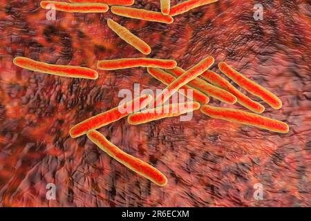 Tuberkulosebakterien. Computerdarstellungen von Mycobacterium tuberculosis-Bakterien, den Gram-positiven Stabbakterien, die die Krankheit tubercu verursachen Stockfoto