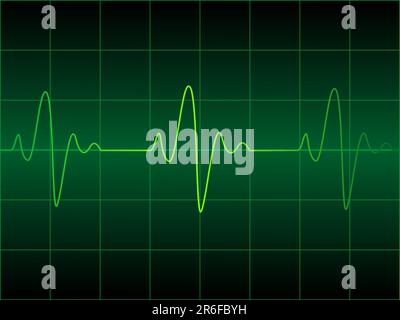 Vektordarstellung des Herzkardiogramms Stock Vektor