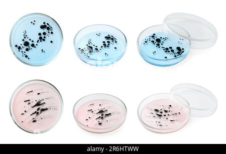 Collage von Petrischalen mit Bakterienkultur auf weißem Hintergrund, verschiedene Winkel Stockfoto